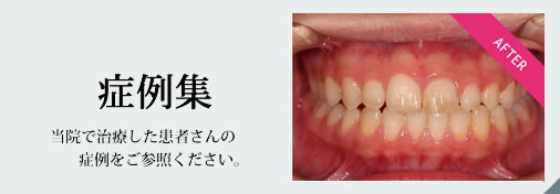 症例集