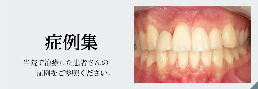 症例集