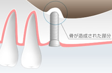 STEP3.待機期間