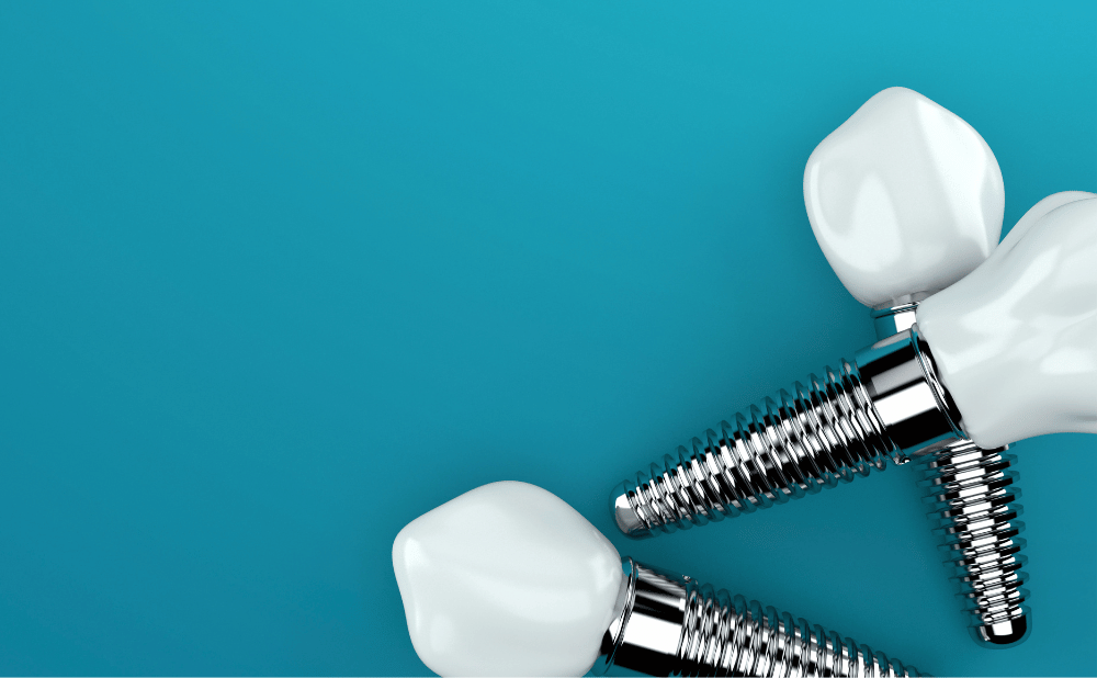 あま市から通えるインプラント治療ができる歯科医院まとめ