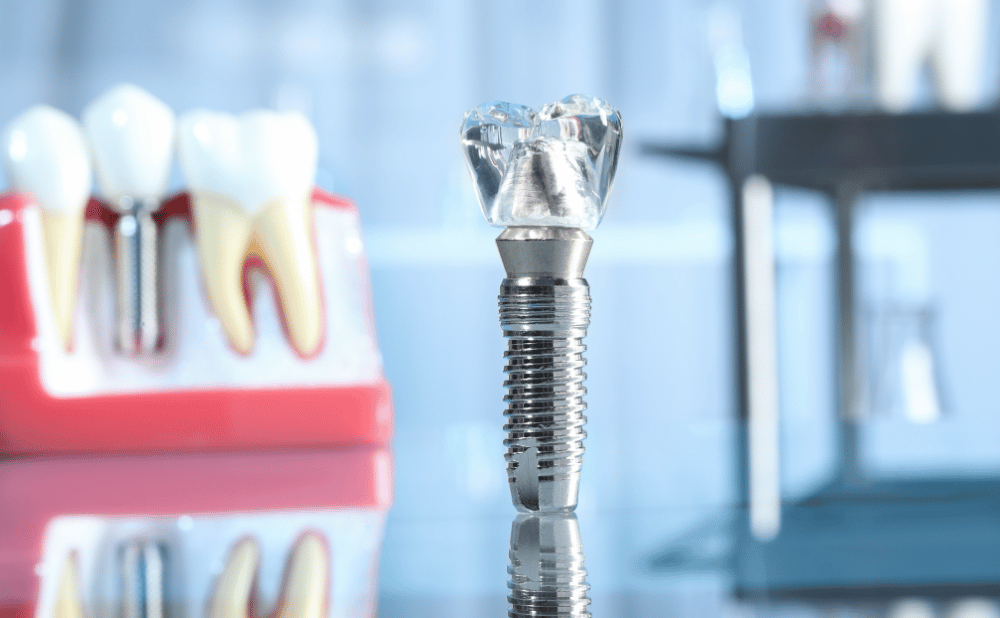 まとめ:安城市からでも安全にインプラント治療を受けるには