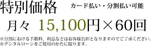 インビザラインの料金